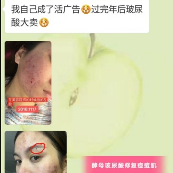 xeq**原液精华液面膜 先摸水还是xeq**原液精华液