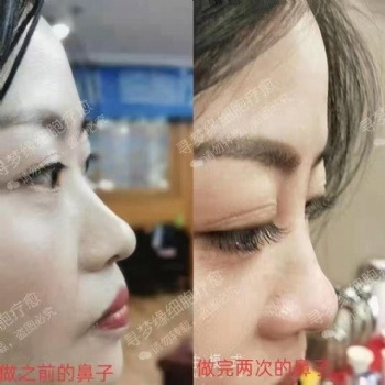 寻梦缘美业 针灸 微整 零成本助你创造百万业绩