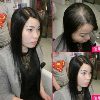 南阳女士假发定制，脱发人士变美神器