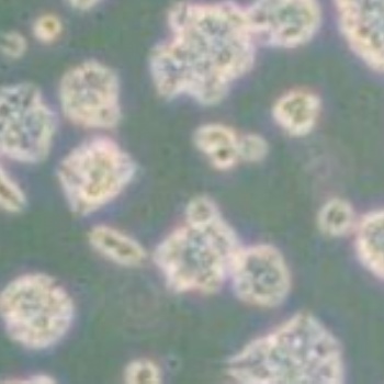 人支气管上皮细胞HBEpiC质粒载体网zl-043983