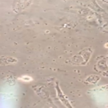 MC38+Luc小鼠结肠癌细胞+Luc智立中特生物