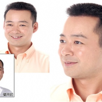 南阳假发·千丝美补发竭诚为您服务
